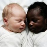Black and white twins born to white parents. Doctors stunned by the impossible occurrence.